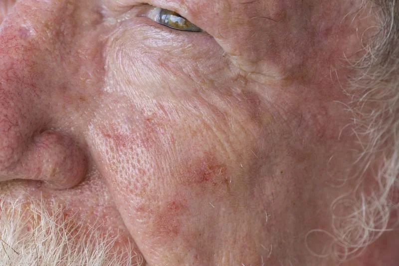 Warthan Dermatology Mohs Skin Cancer Surgery Center photo 1