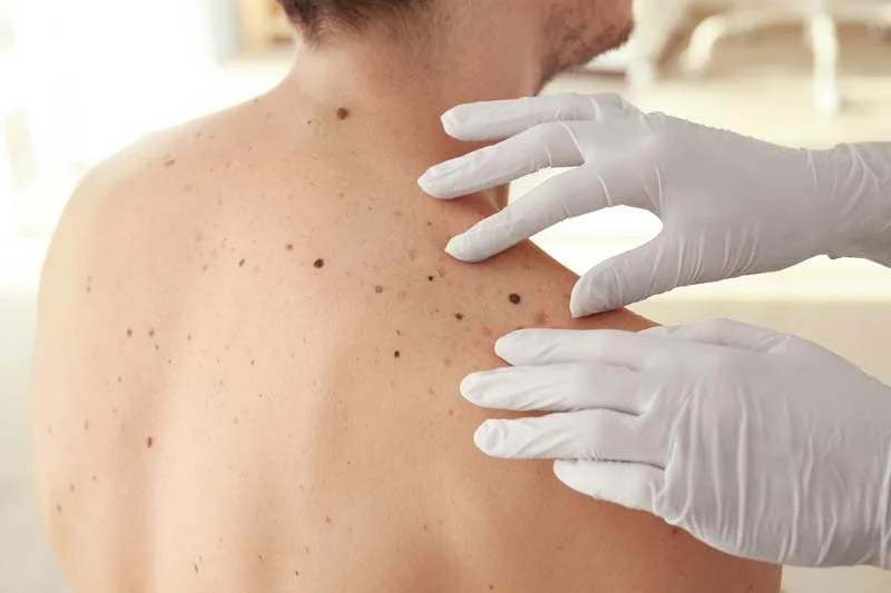 Warthan Dermatology Mohs Skin Cancer Surgery Center photo 2