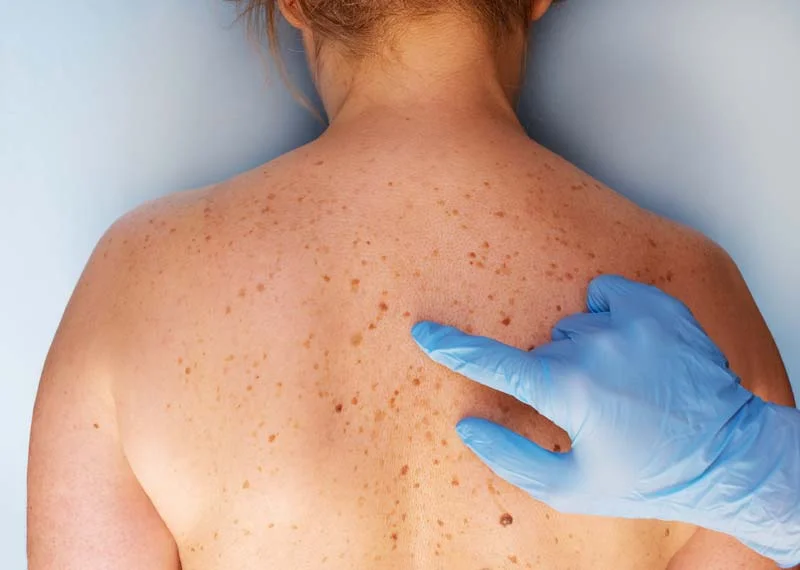Warthan Dermatology Mohs Skin Cancer Surgery Center photo 4