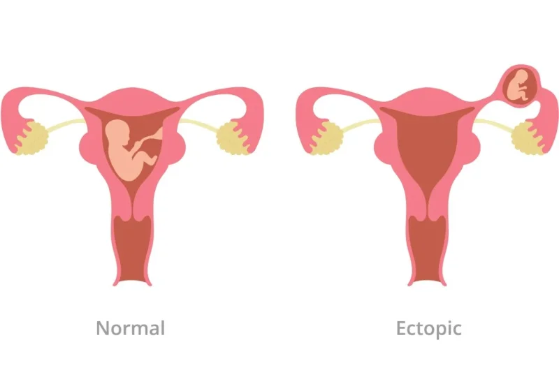 Dr. Megha Agrawal, Gynecologist & Laparoscopic Surgeon in Indore photo 1