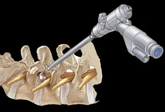 Dr. Anshul Agrawal - Pain Management Specialist in Indore | Sparsh Spine and Pain Centre photo 4