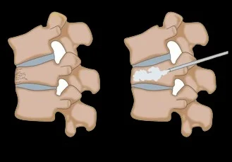 Dr. Anshul Agrawal - Pain Management Specialist in Indore | Sparsh Spine and Pain Centre photo 5