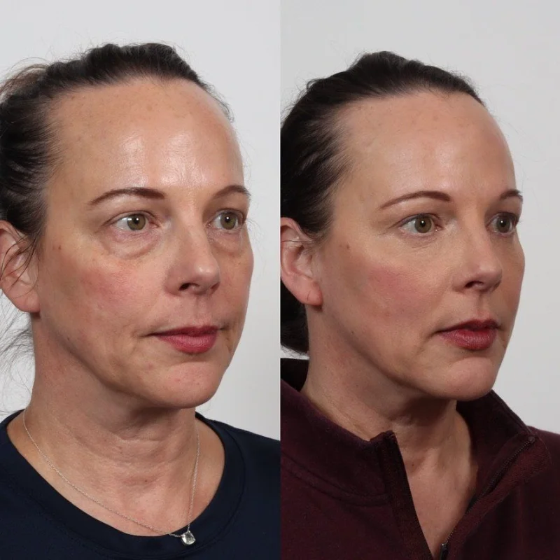 Locketz Facial Plastic Surgery photo 1