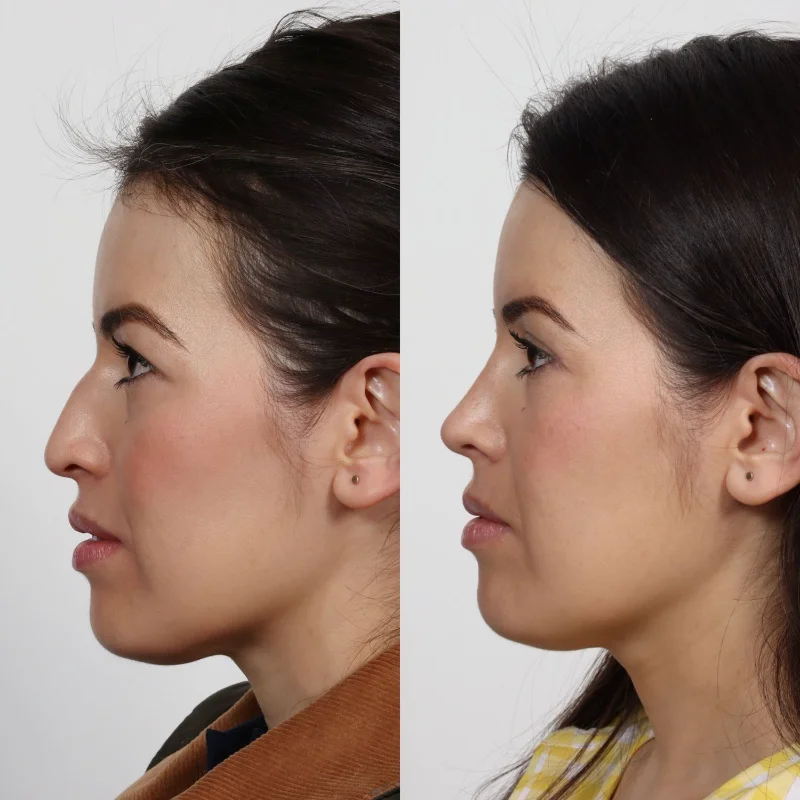 Locketz Facial Plastic Surgery photo 3