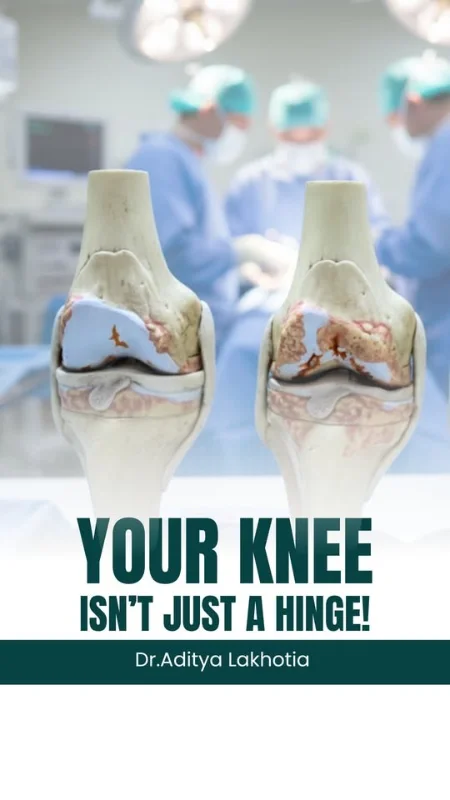 Dr. Aditya Lakhotia - Robotic Knee & Hip Replacement Specialist photo 5