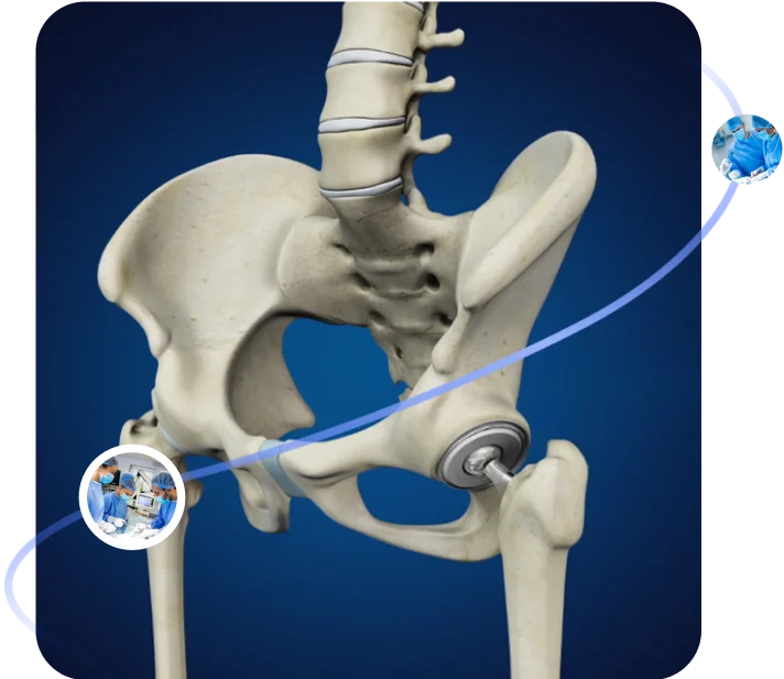 Dr Vikas Jain | Hip Replacement Surgeon in Indore photo 1